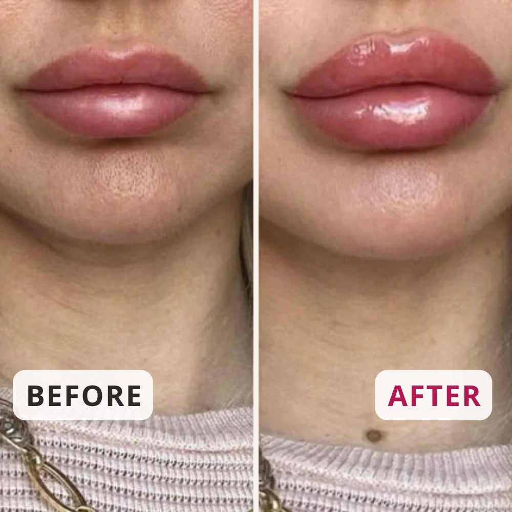 Ice Crystals Lip Plumper – Plumping & Hydrating Lip Serum