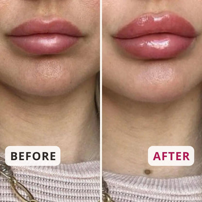 Ice Crystals Lip Plumper – Plumping & Hydrating Lip Serum