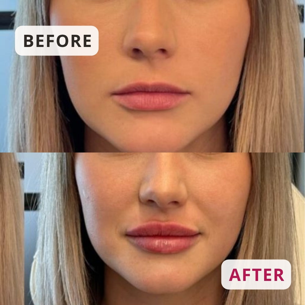 Ice Crystals Lip Plumper – Plumping & Hydrating Lip Serum